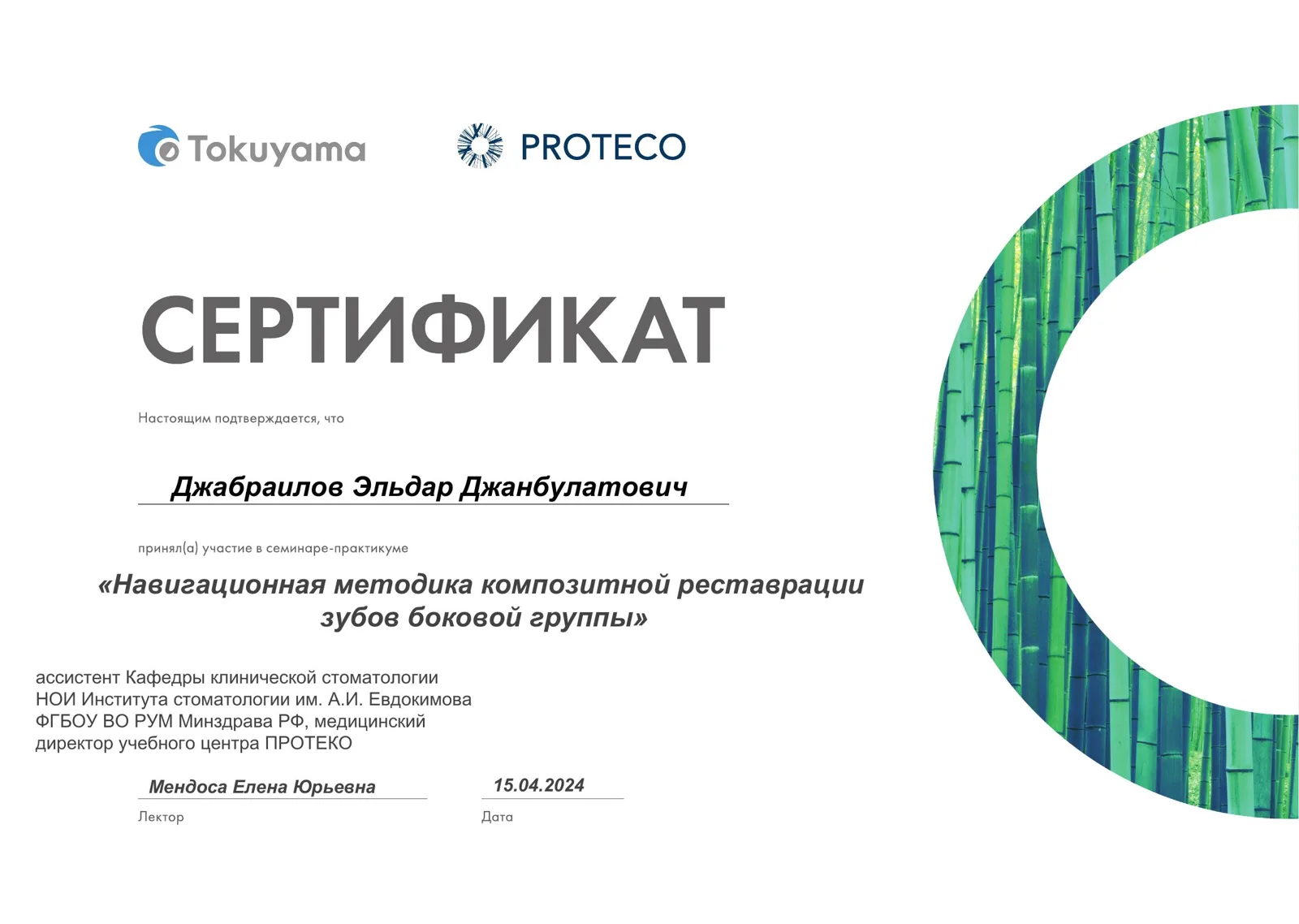 Навигационная методика композитной реставрации зубов боковой группы