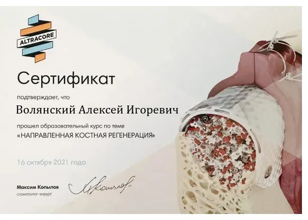 Направленная костная регенерация