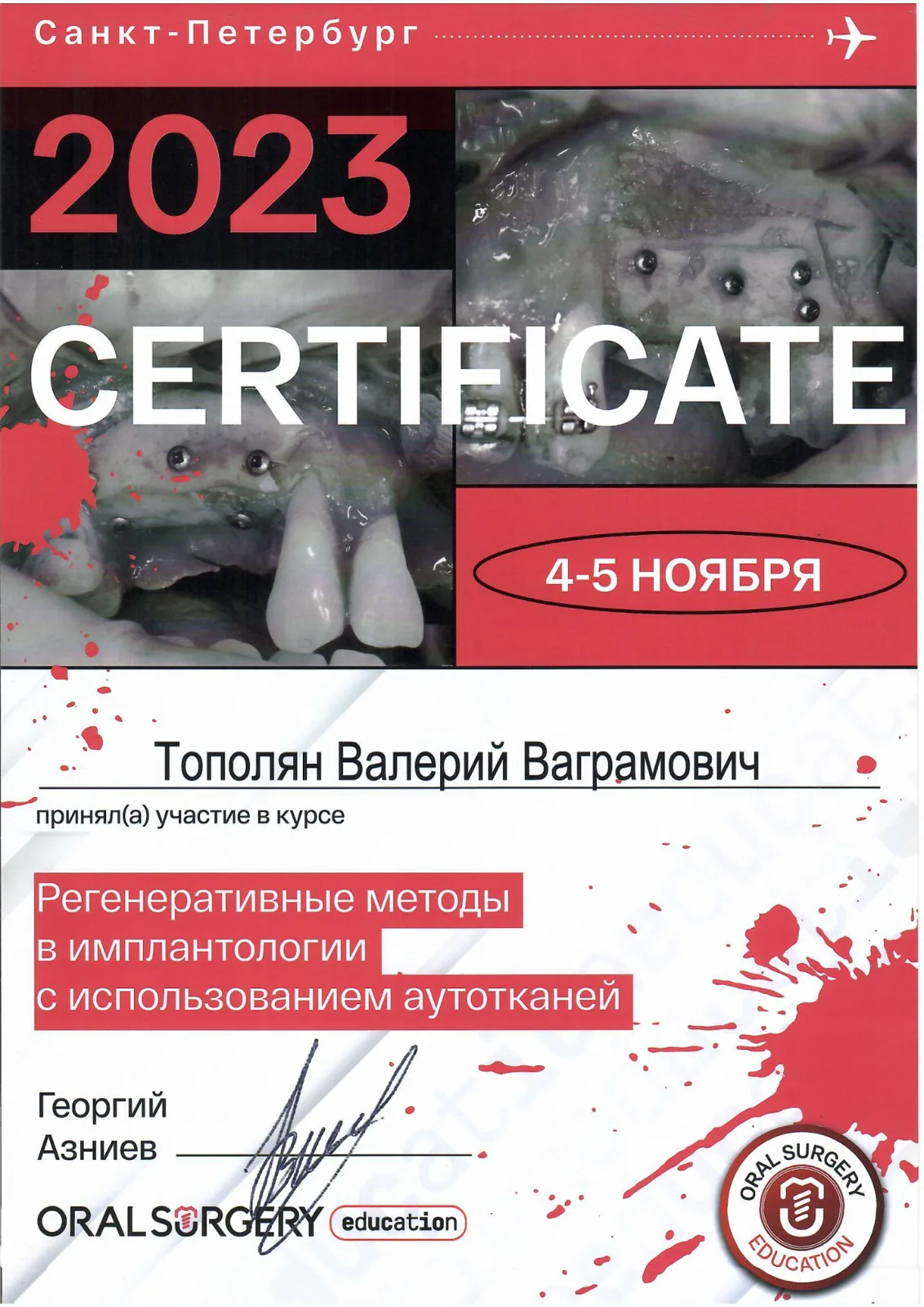 Регенеративные методы в имплантологии с использованием аутотканей